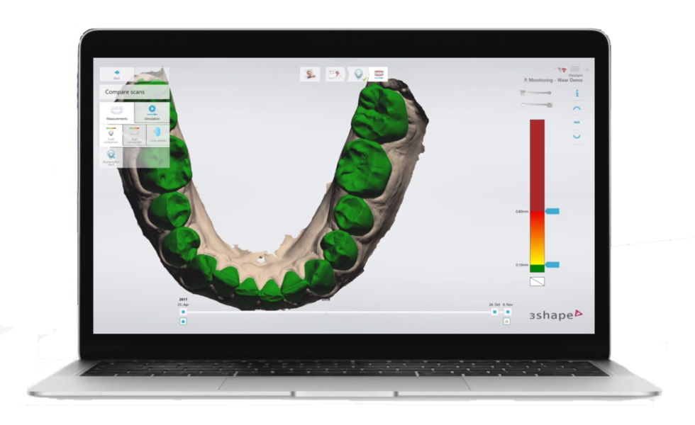 Trios | Plandent CAD/CAM